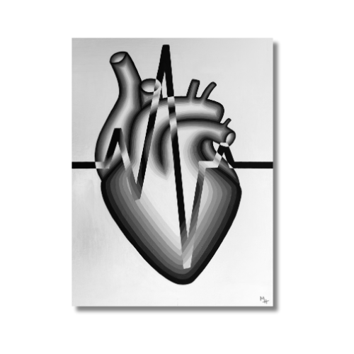 Inverted Black and White Heart (Limited Edition Print on Canvas)