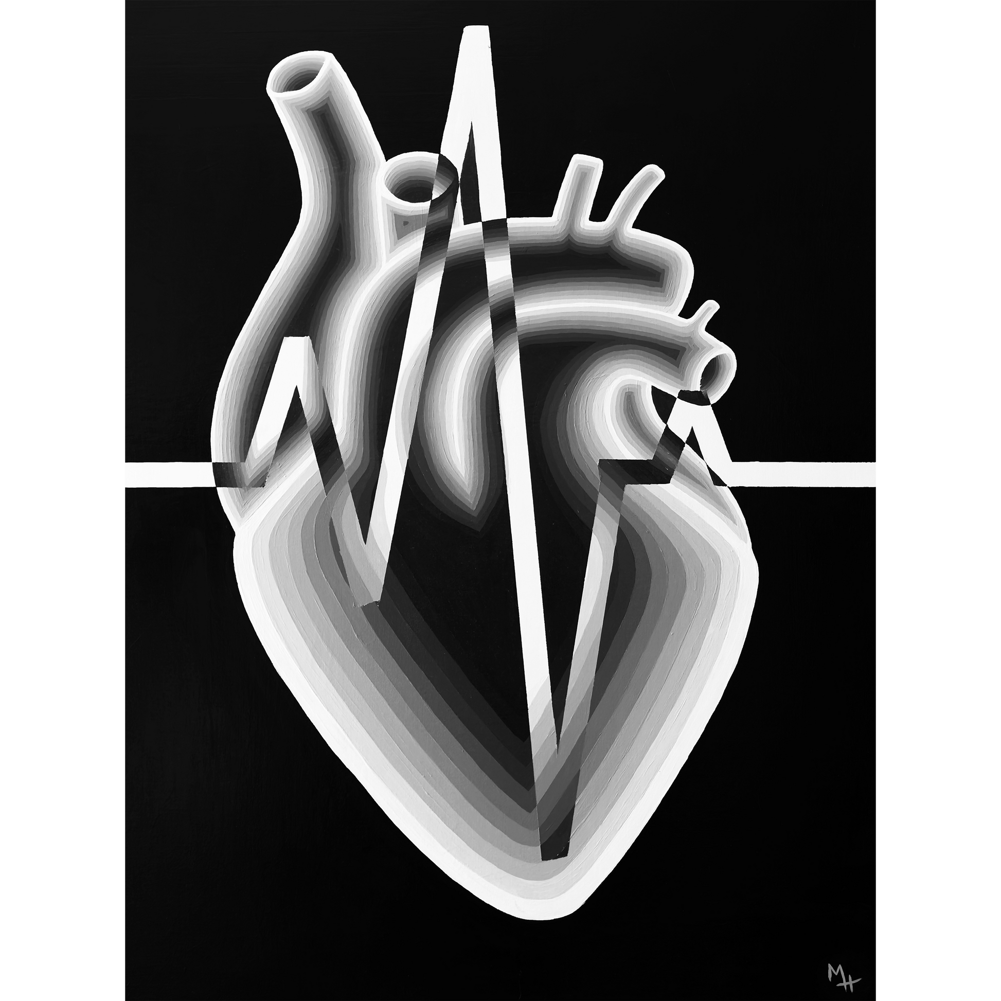 “Black and White Heart” Print